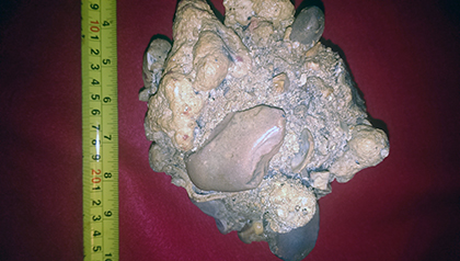 Enter your image caption here