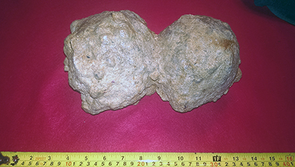 Enter your image caption here